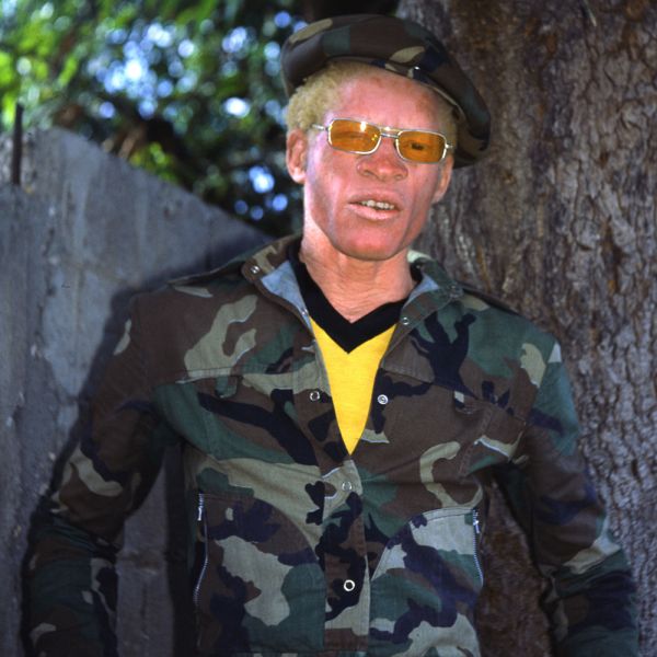 Fichier:Yellowman.jpg